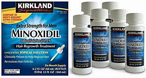 Scalp is overly dry due to minoxidil for hair loss